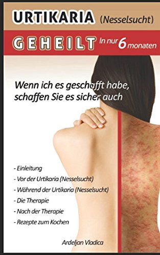 Urtikaria(Nesselsucht)geheilt in nur 6 monaten: Wenn ich geschafft habe,schaffen sie es sicher auch Health, Nutrition & Fitness