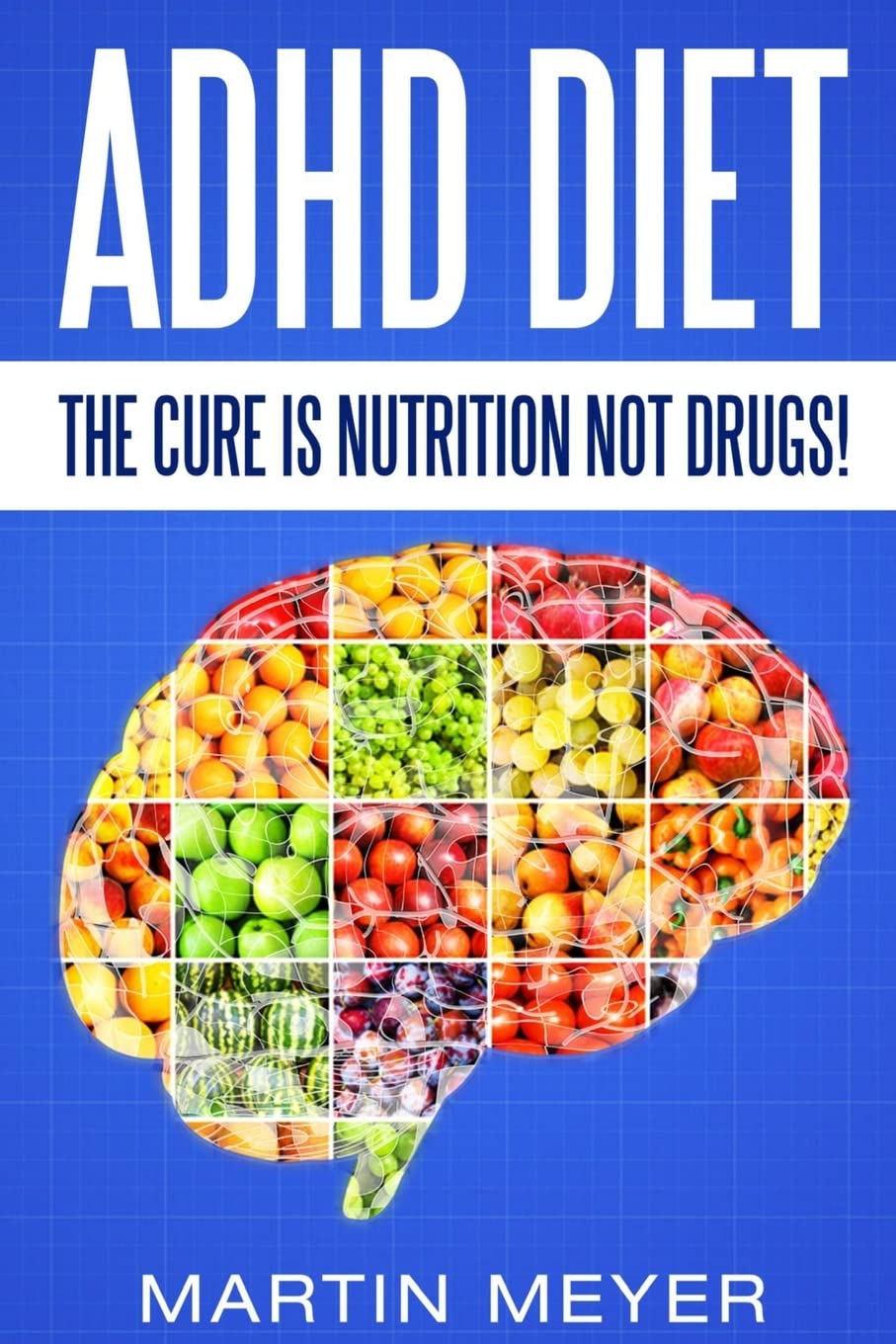 ADHD Diet: The Cure Is Nutrition Not Drugs (For: Children, Adult ADD, Marriage, Psychology