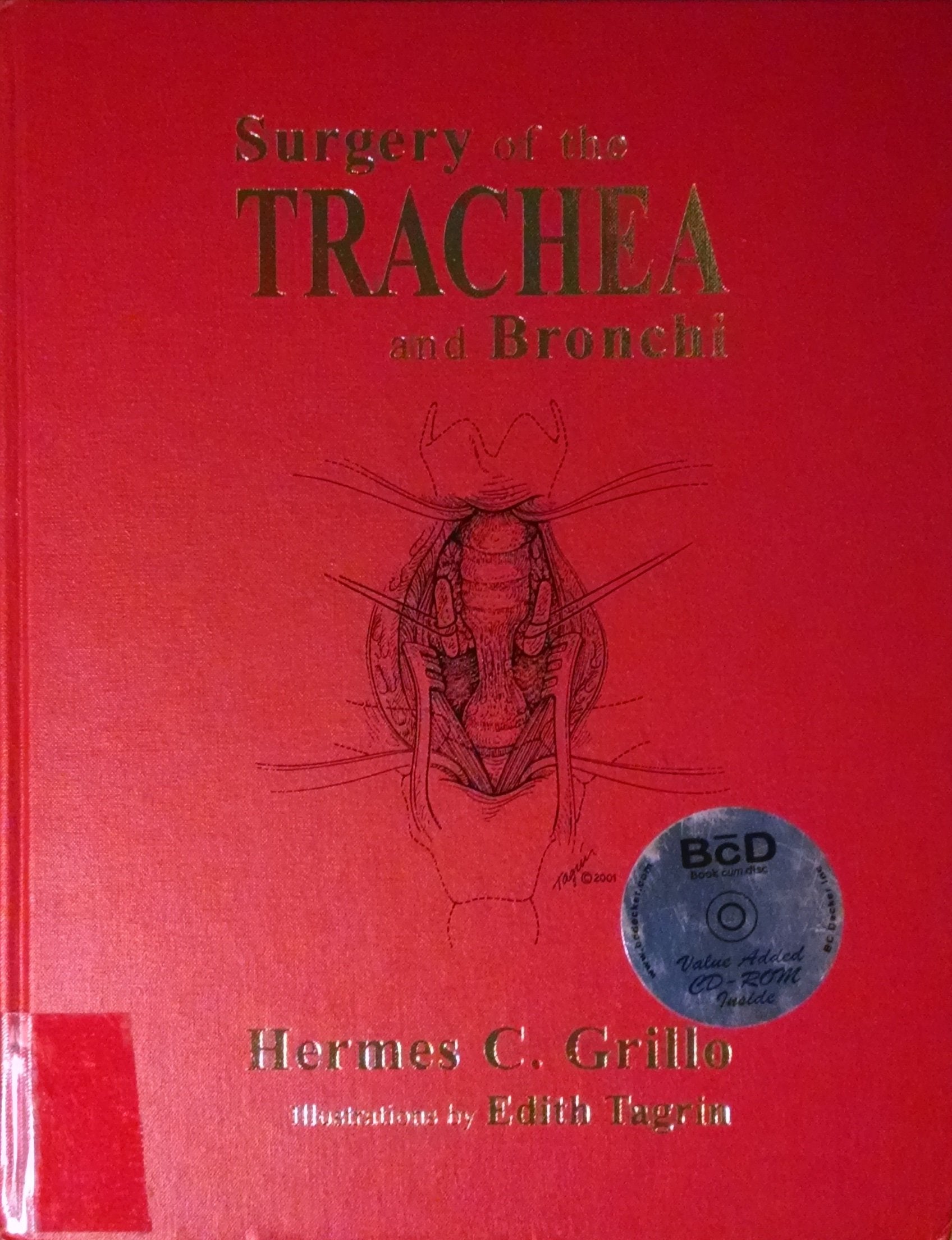 Surgery of the Trachea and Bonchi Medicine