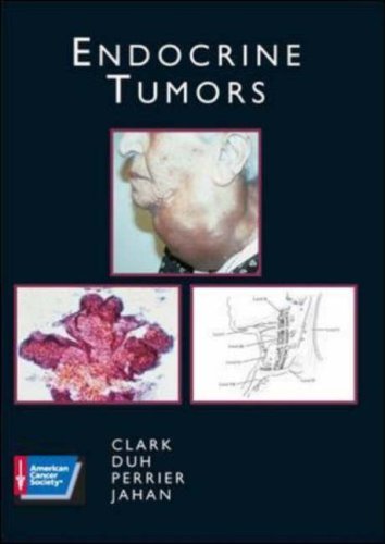 Endocrine Tumors: American Cancer Society Atlas of Clinical Oncology Medicine
