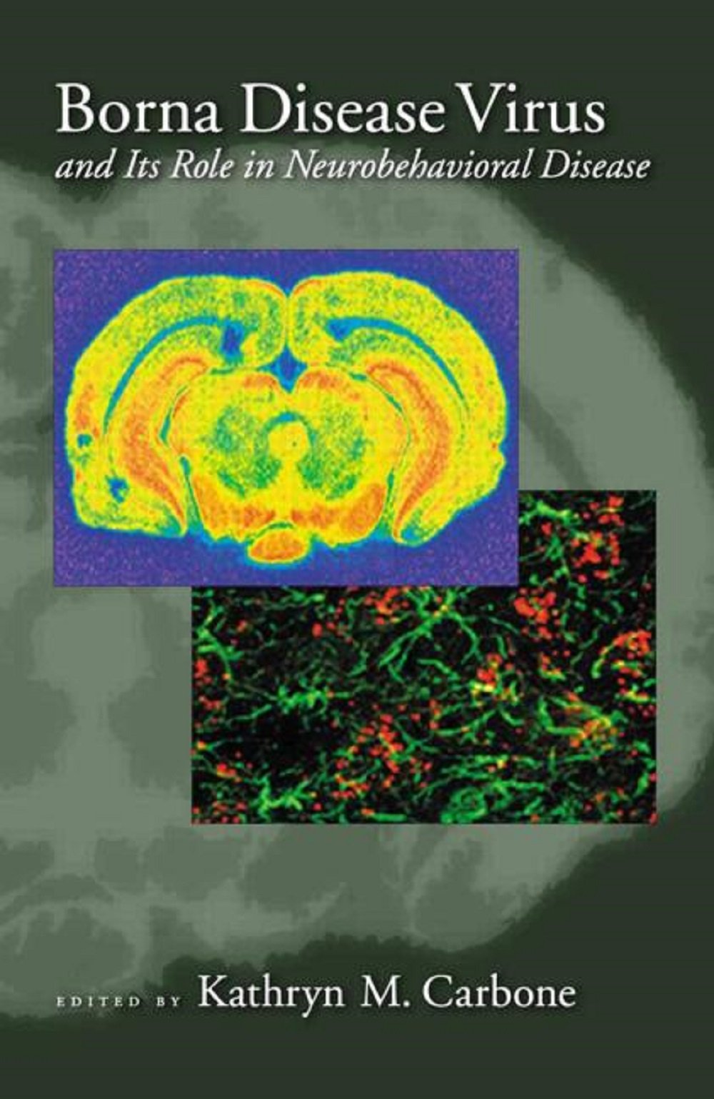 Borna Disease Virus: Role in Neurbehavioral Disease Medicine