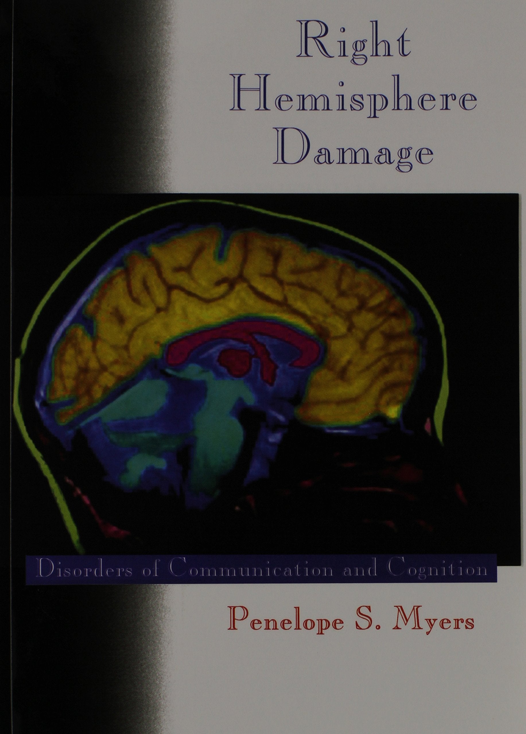 Right Hemisphere Damage: Disorders of Communication and Cognition book