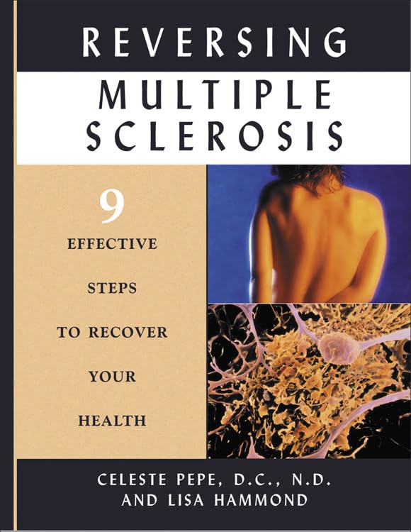 Reversing Multiple Sclerosis: 9 Effective Steps to Recover Your Health: 9 Effective Steps to Recover Your Health Learning & Reference