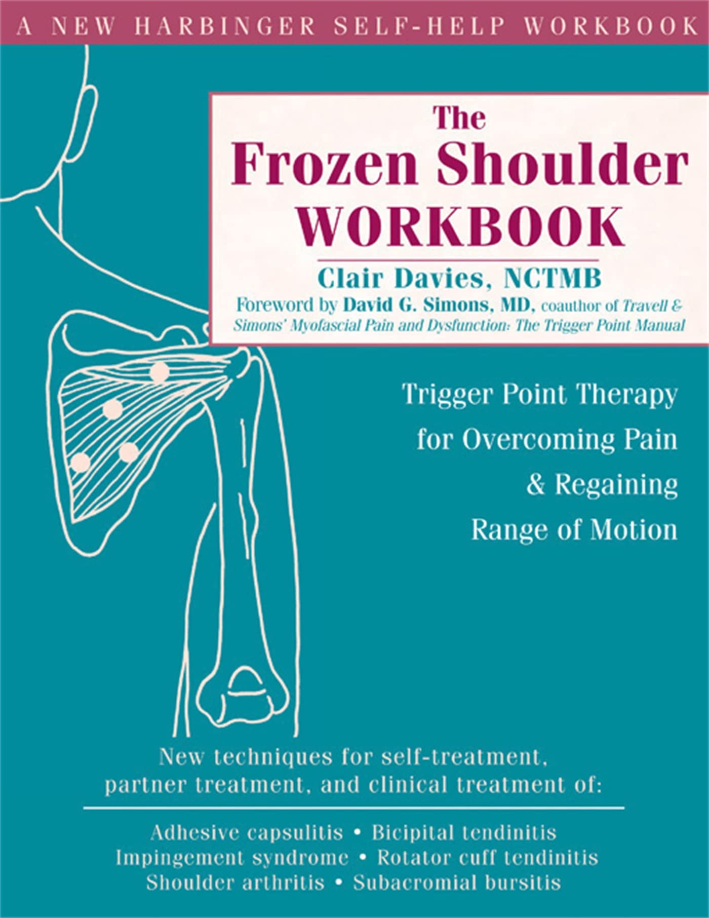 The Frozen Shoulder Workbook: Trigger Point Therapy for Overcoming Pain & Regaining Range of Motion Medicine