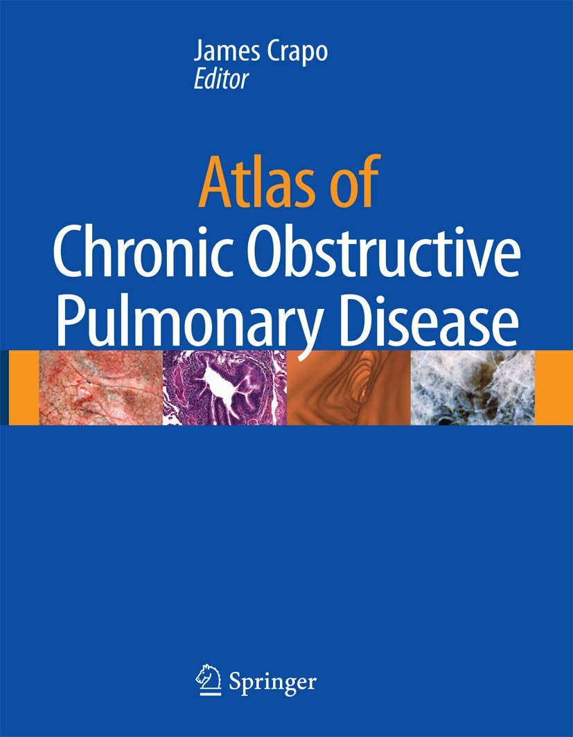 Atlas of Chronic Obstructive Pulmonary Disease Medicine