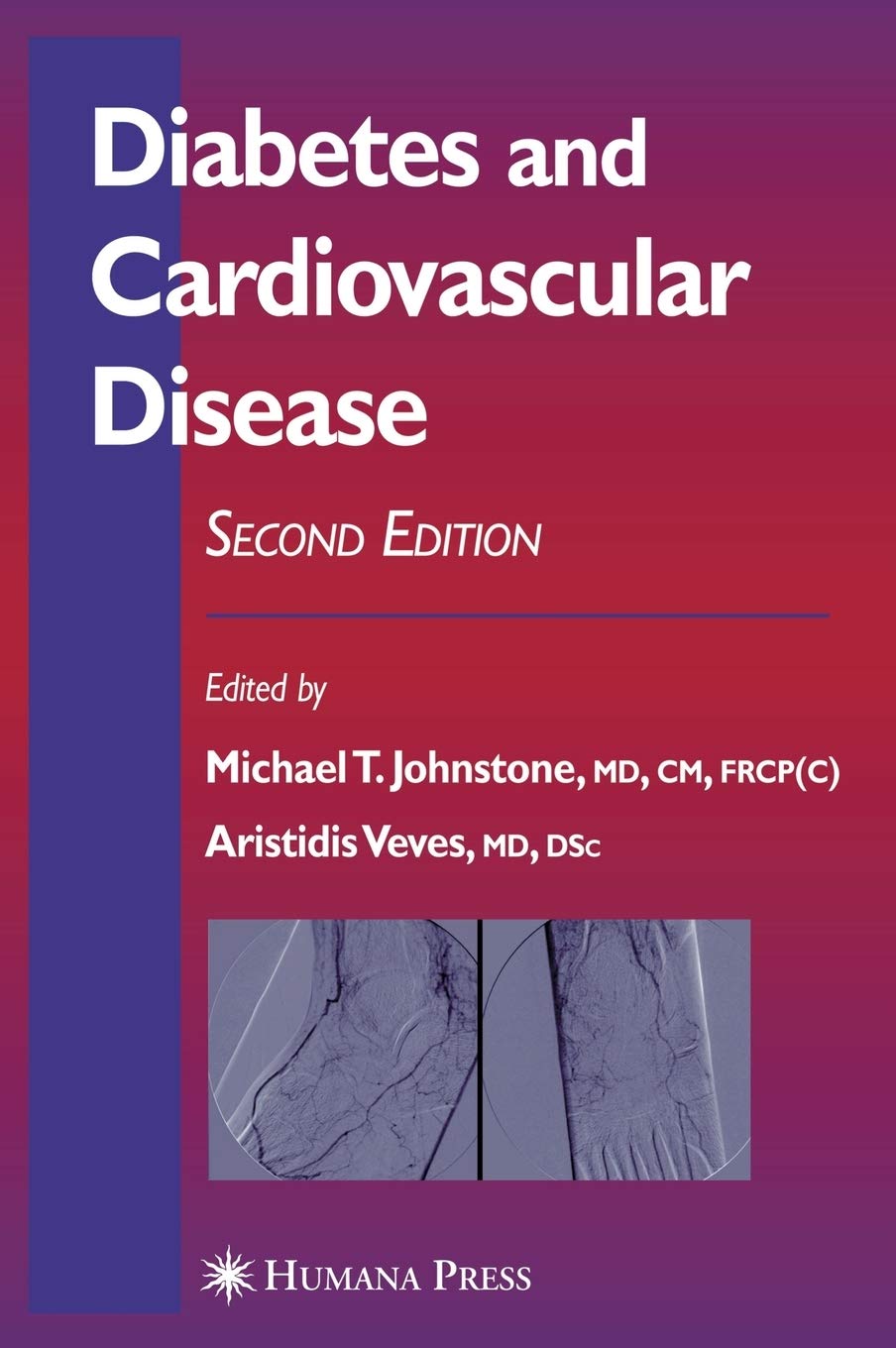 Diabetes and Cardiovascular Disease (Contemporary Cardiology) Medicine