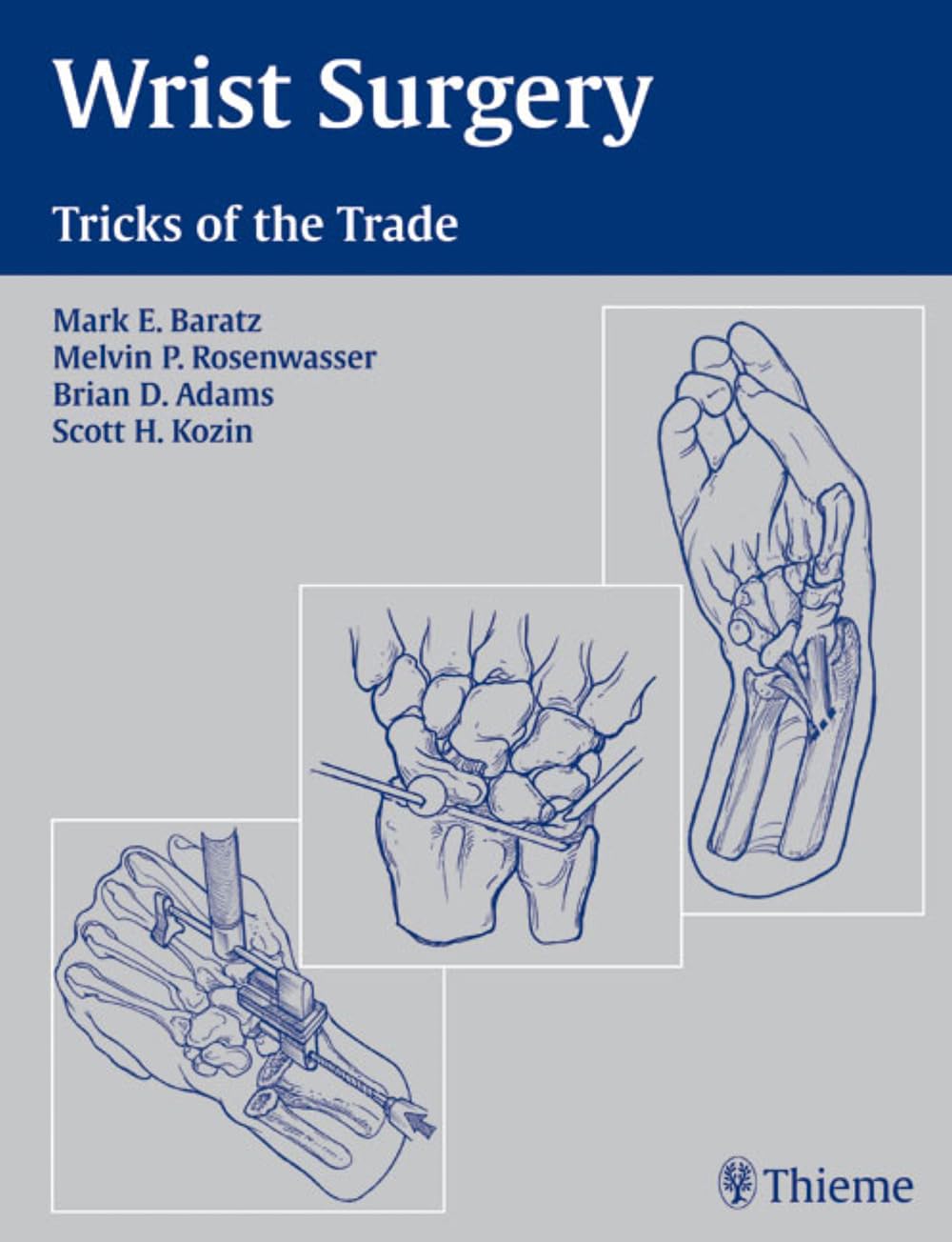 Wrist Surgery: Tricks of the Trade Medicine