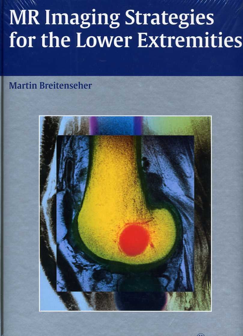 MR Imaging Strategies For The Lower Extremities Medicine
