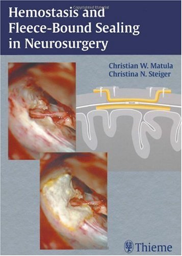 Hemostasis and Fleece-Bound Sealing in Neurosurgery Medicine