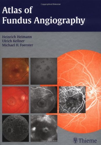 Atlas of Fundus Angiography book