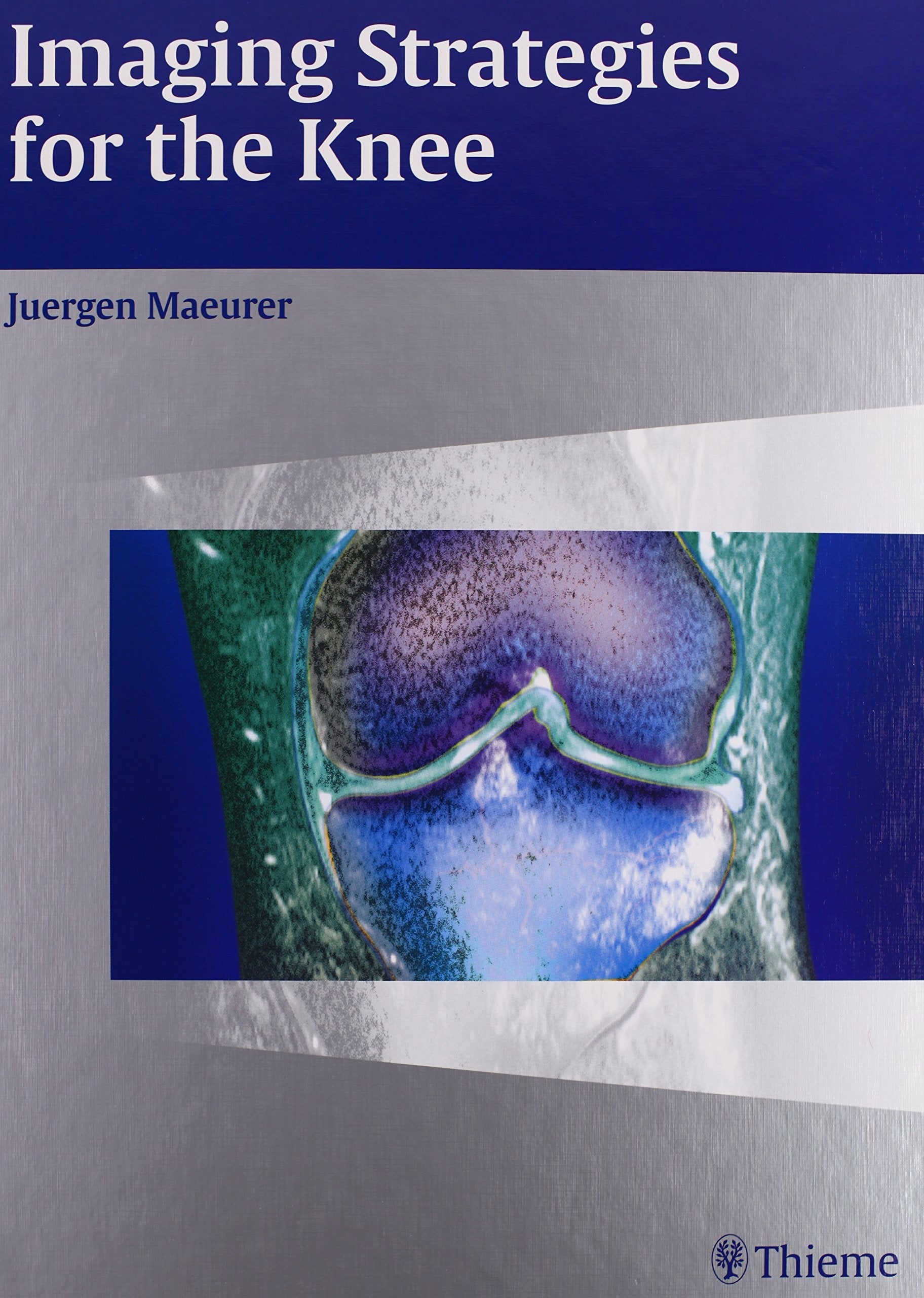 Imaging Strategies for the Knee: Medicine