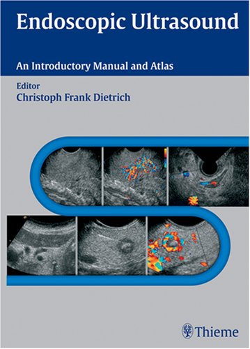 Endoscopic Ultrasound: An Introductory Manual And Atlas book