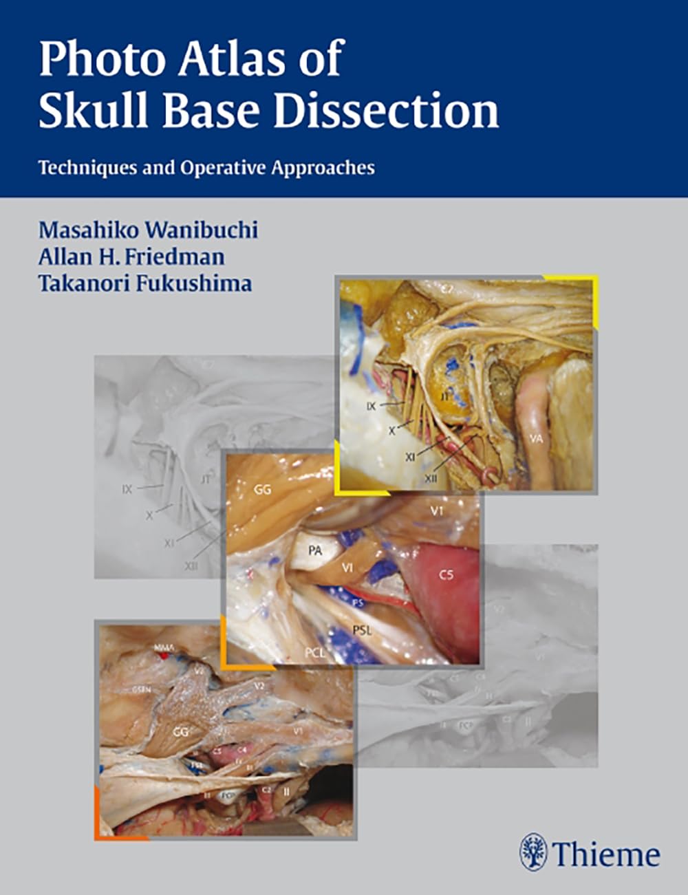 Photo Atlas of Skull Base Dissection: Techniques and Operative Approaches book