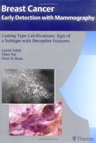 Casting Type Calcifications: Sign of a Subtype With Deceptive Features (Breast Cancer: Early Detection With Mammography) Medicine