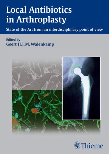 Local Antibiotics in Arthroplasty: State of the Art from an Interdisciplinary Point of View Medicine