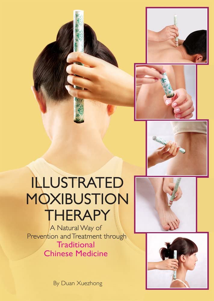 Illustrated Moxibustion Therapy: A Natural Way of Prevention and Treatment Through Traditional Chinese Medicine Medicine
