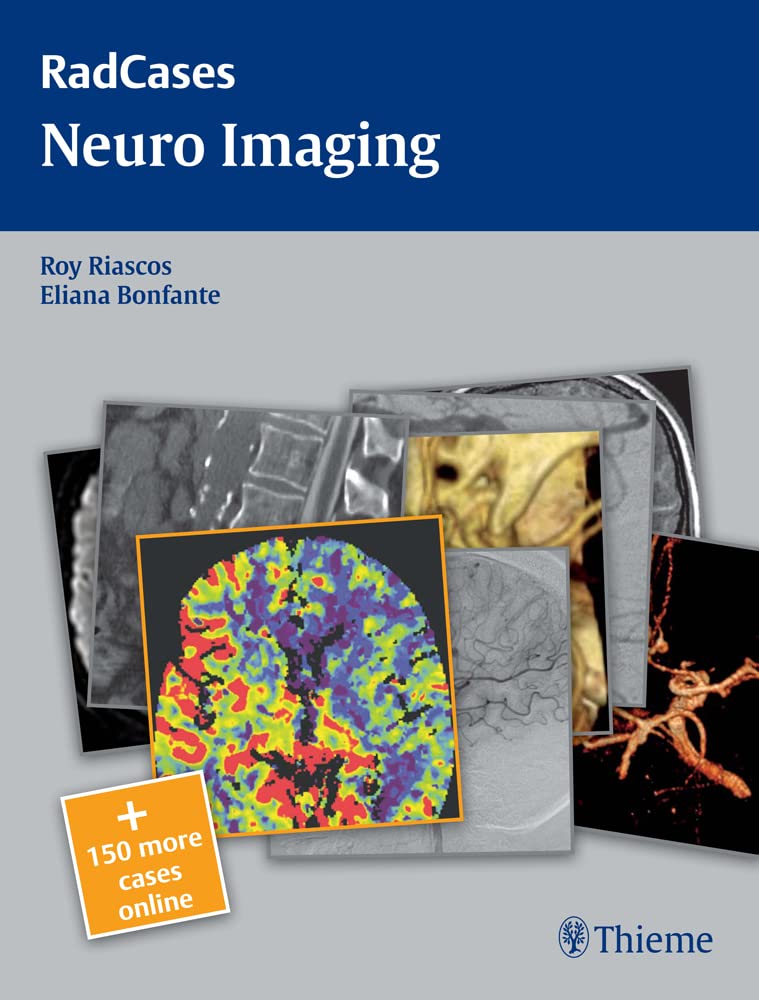 Radcases Neuro Imaging: + 150 more cases online (Radcases Plus Q&A) Medicine