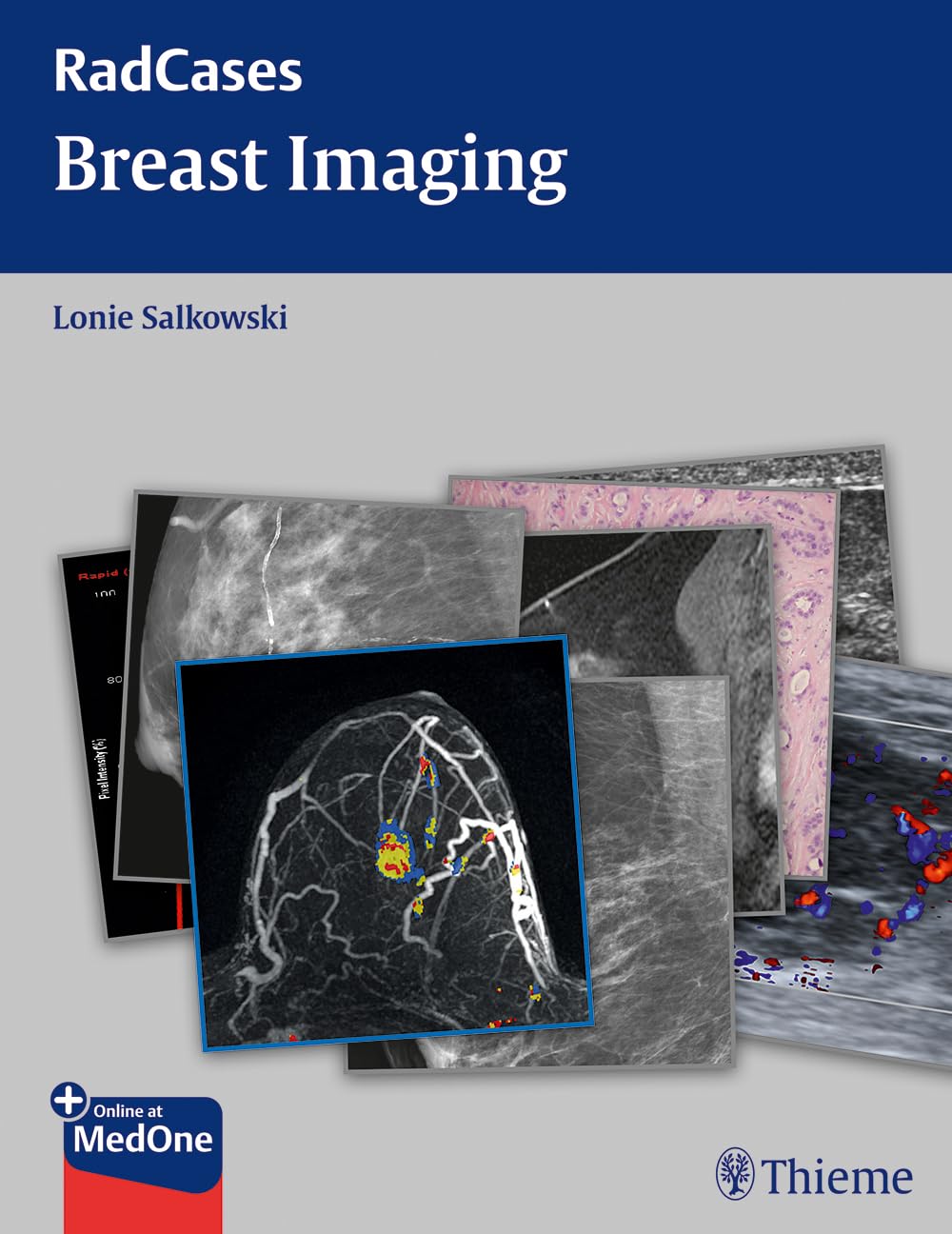 Product Image: Radcases Breast Imaging