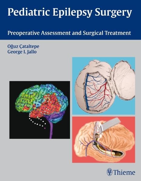 Pediatric Epilepsy Surgery: Preoperative Assessment and Surgical Treatment Medicine