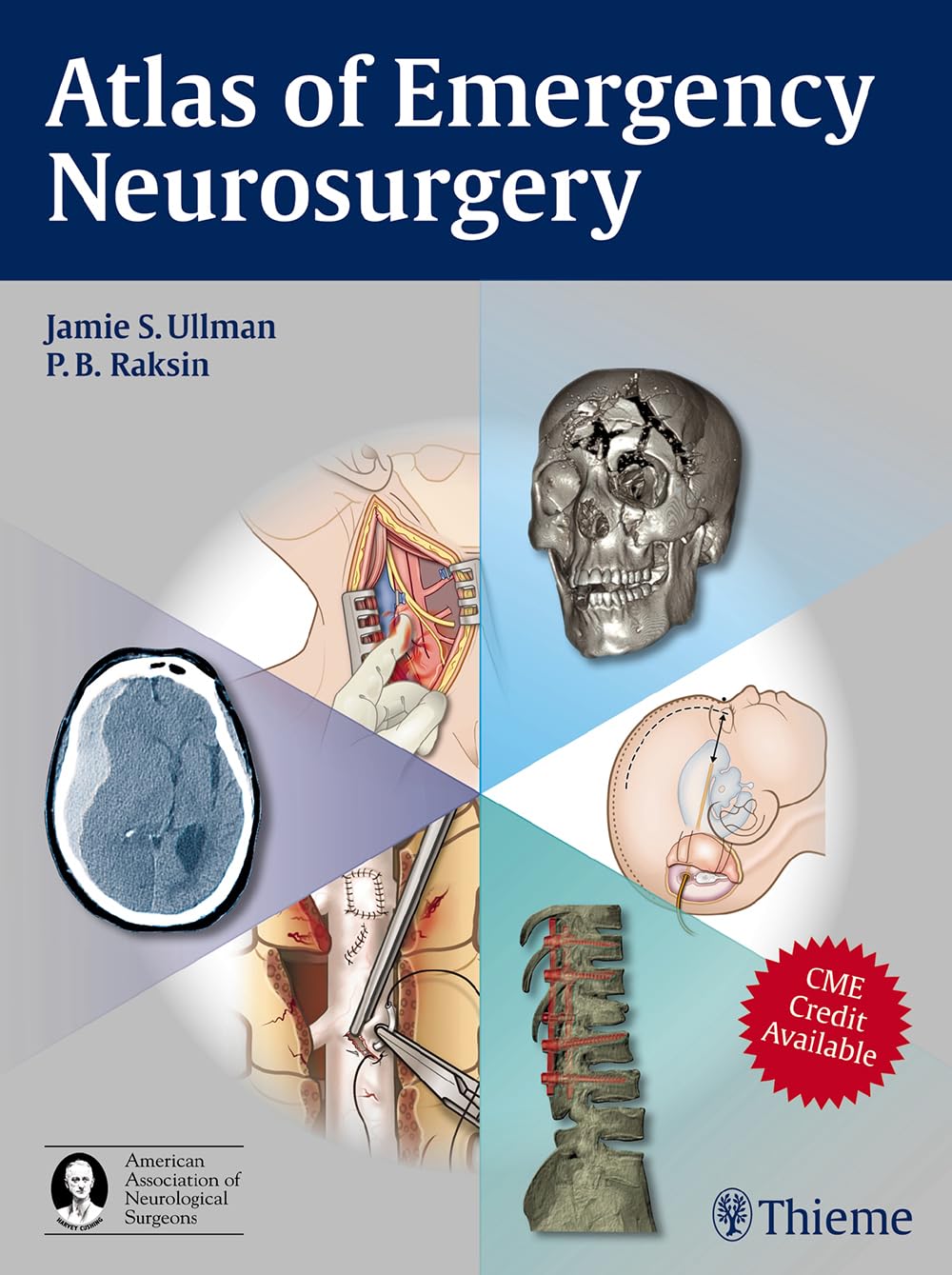 Atlas of Emergency Neurosurgery Medicine