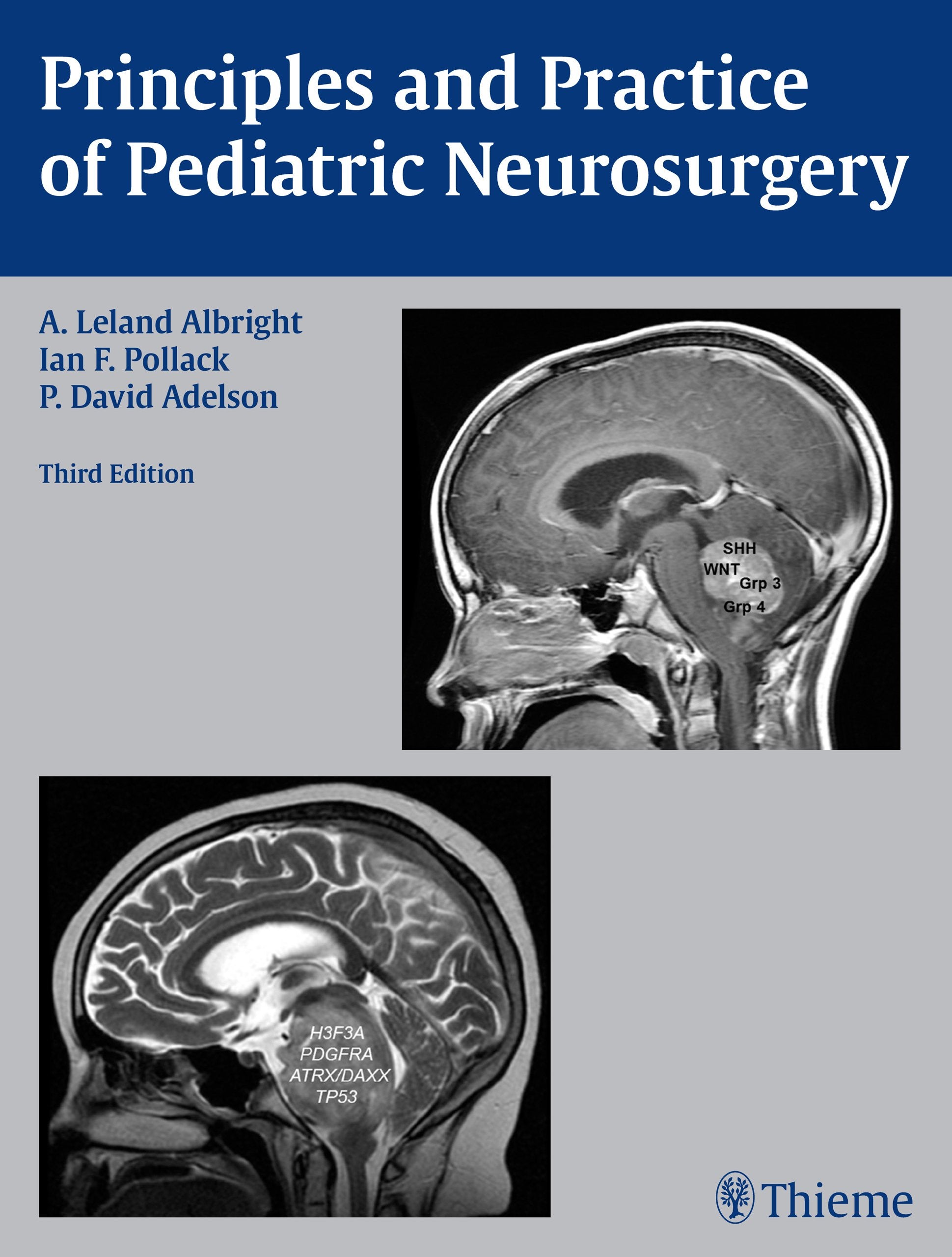 Principles and Practice of Pediatric Neurosurgery book