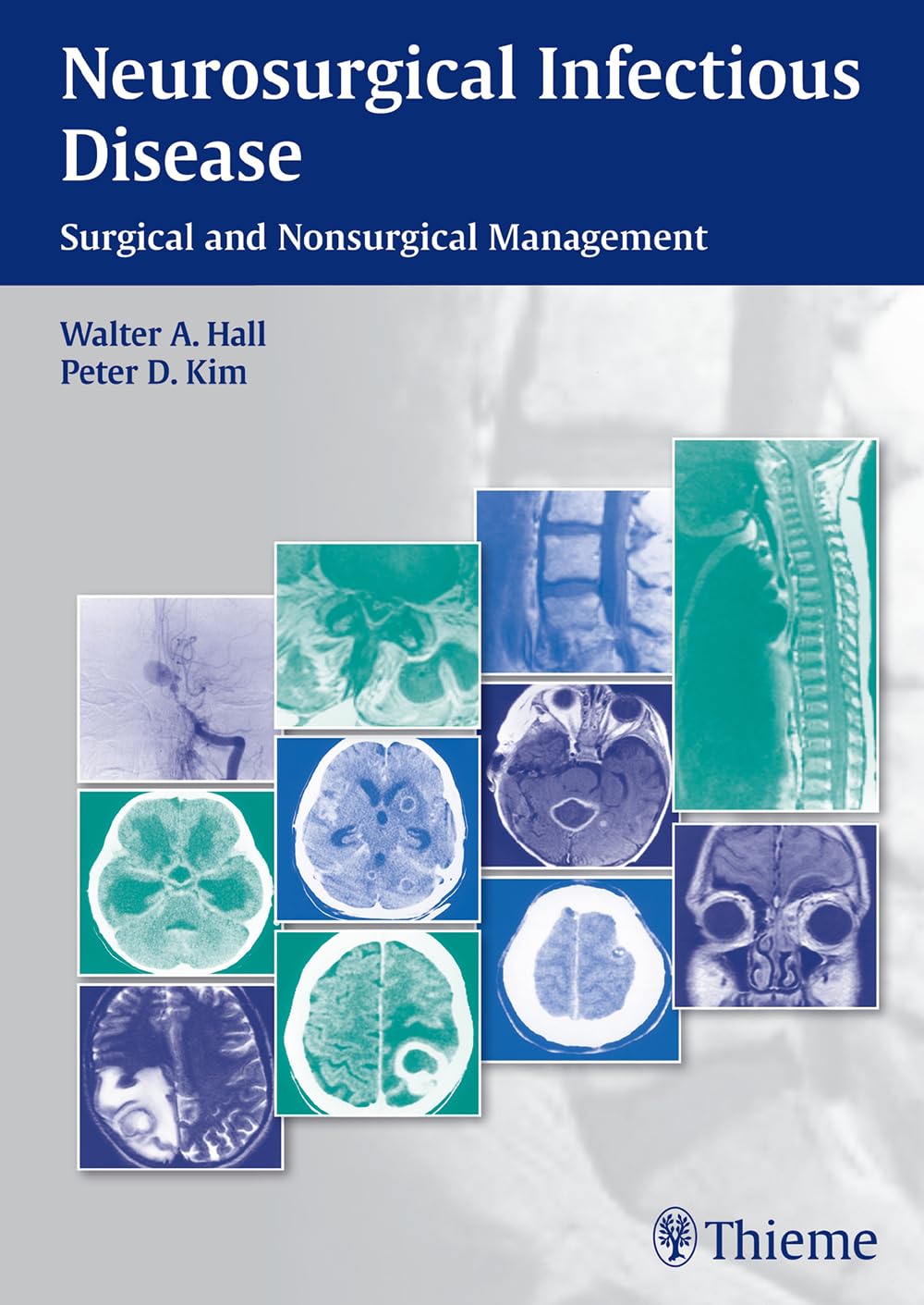 Neurosurgical Infectious Disease: Surgical and Nonsurgical Management book