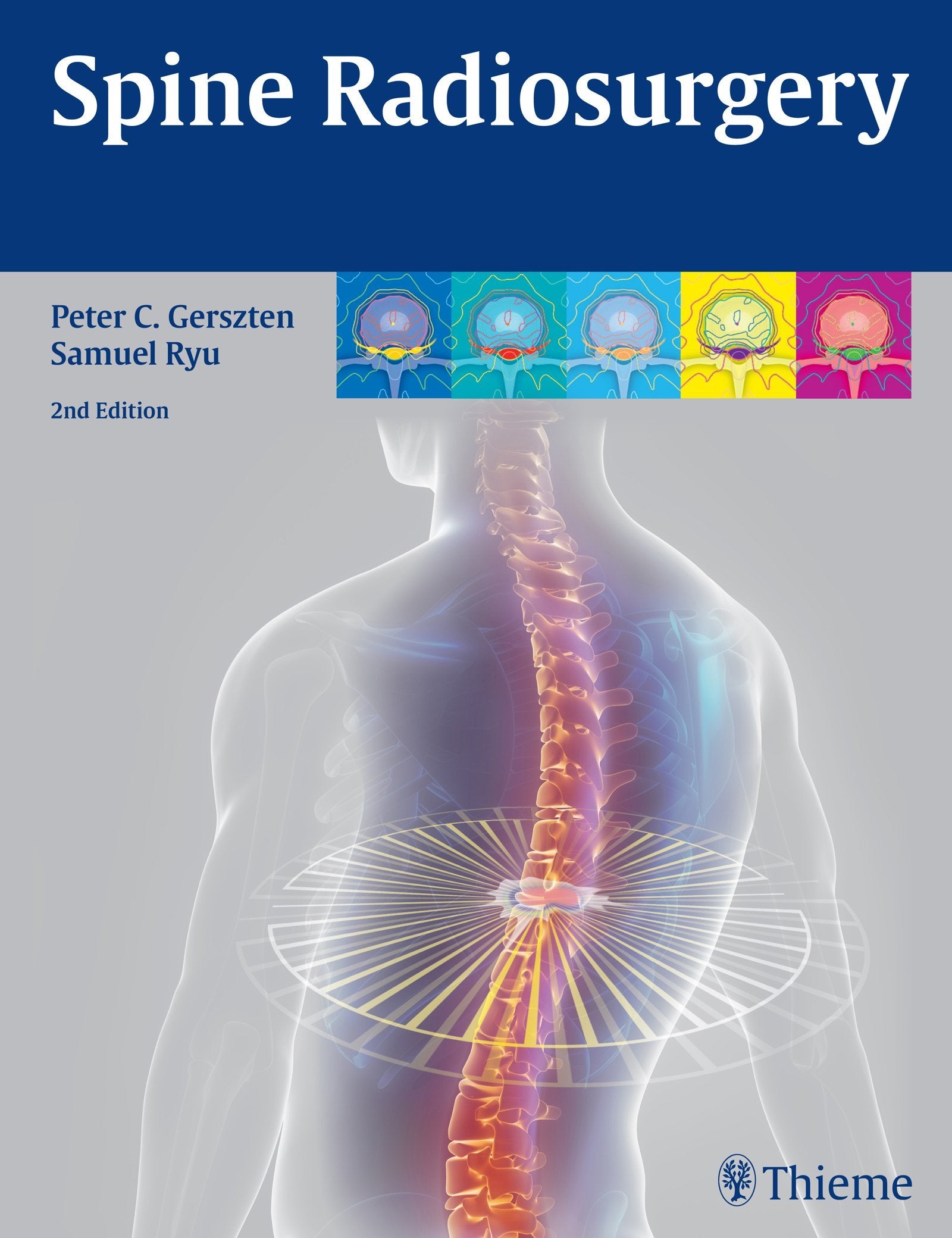 Controversies in Stereotactic Radiosurgery: Best Evidence Recommendations book