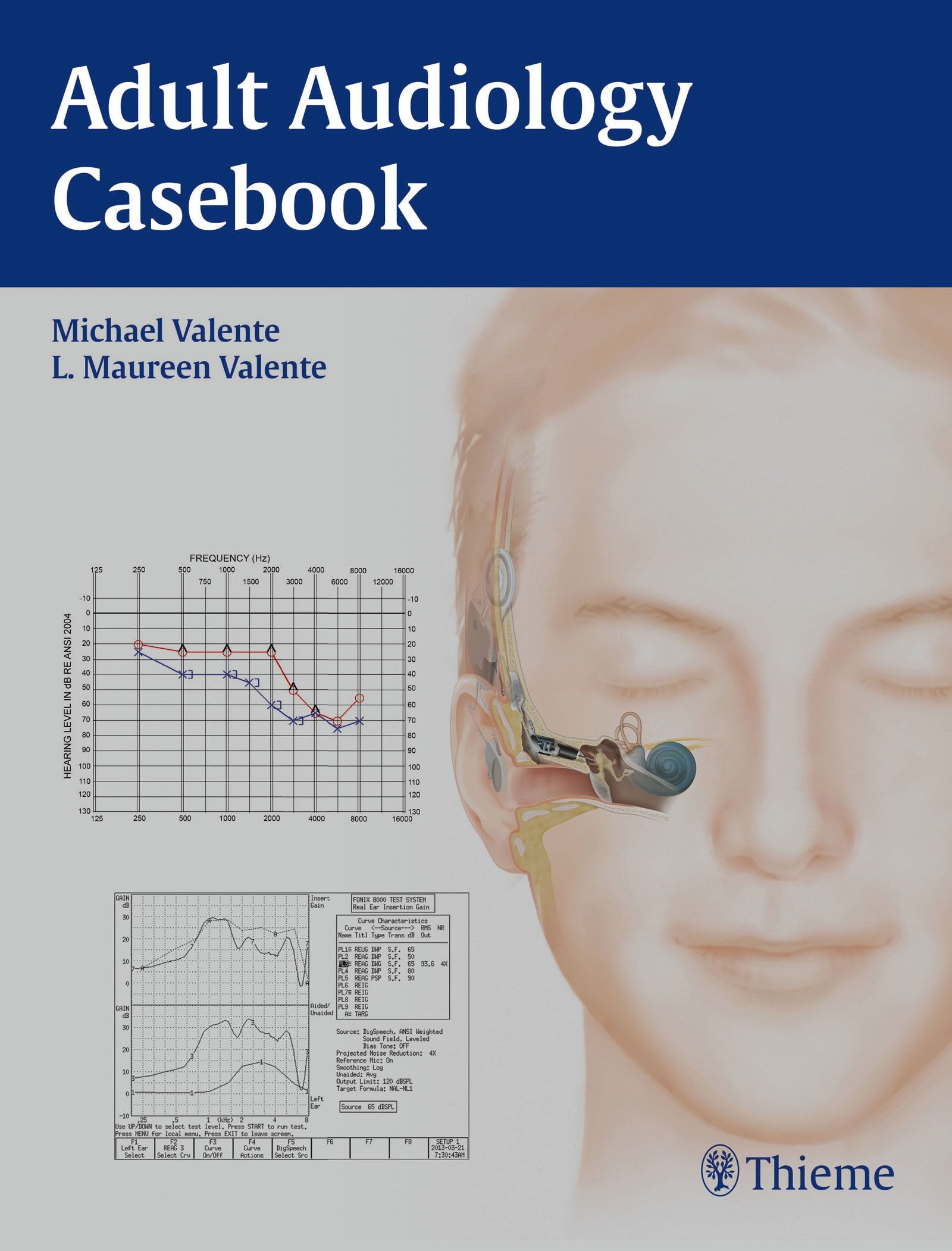 Adult Audiology Casebook Medicine