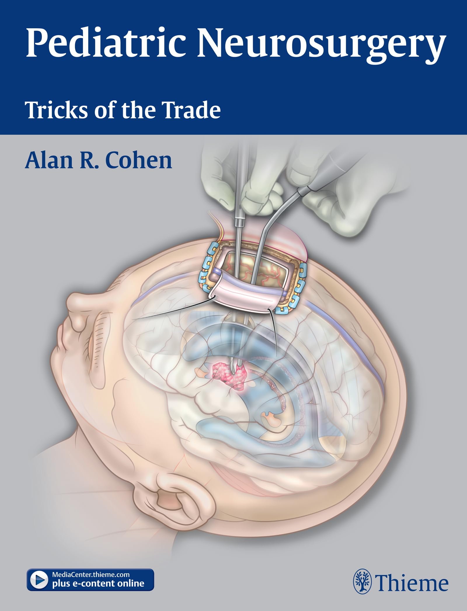 Pediatric Neurosurgery: Tricks of the Trade: Plus e-content online Medicine