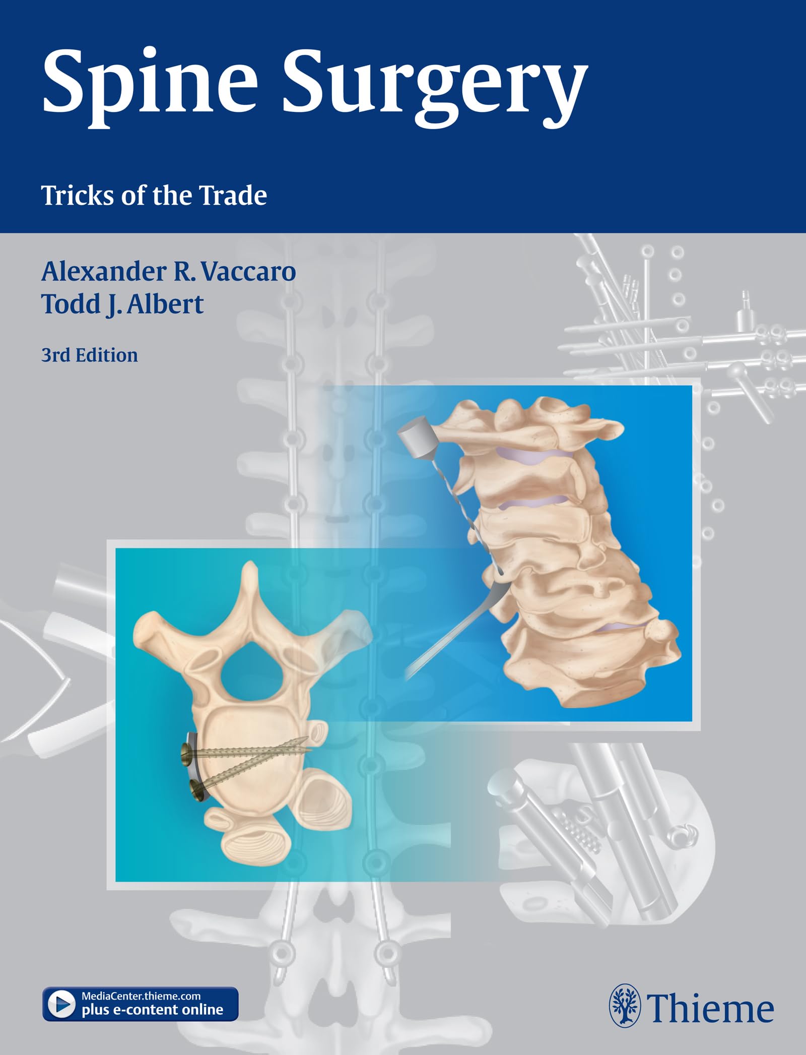 Spine Surgery: Tricks of the Trade book