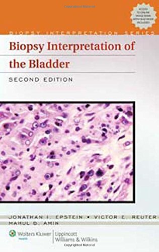 Biopsy Interpretation of the Bladder (Biopsy Interpretation Series) Medicine