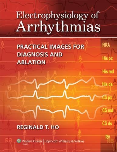 Electrophysiology of Arrhythmias: Practical Images for Diagnosis and Ablation Medicine