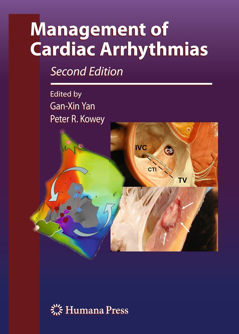 Management of Cardiac Arrhythmias (Contemporary Cardiology) Medicine