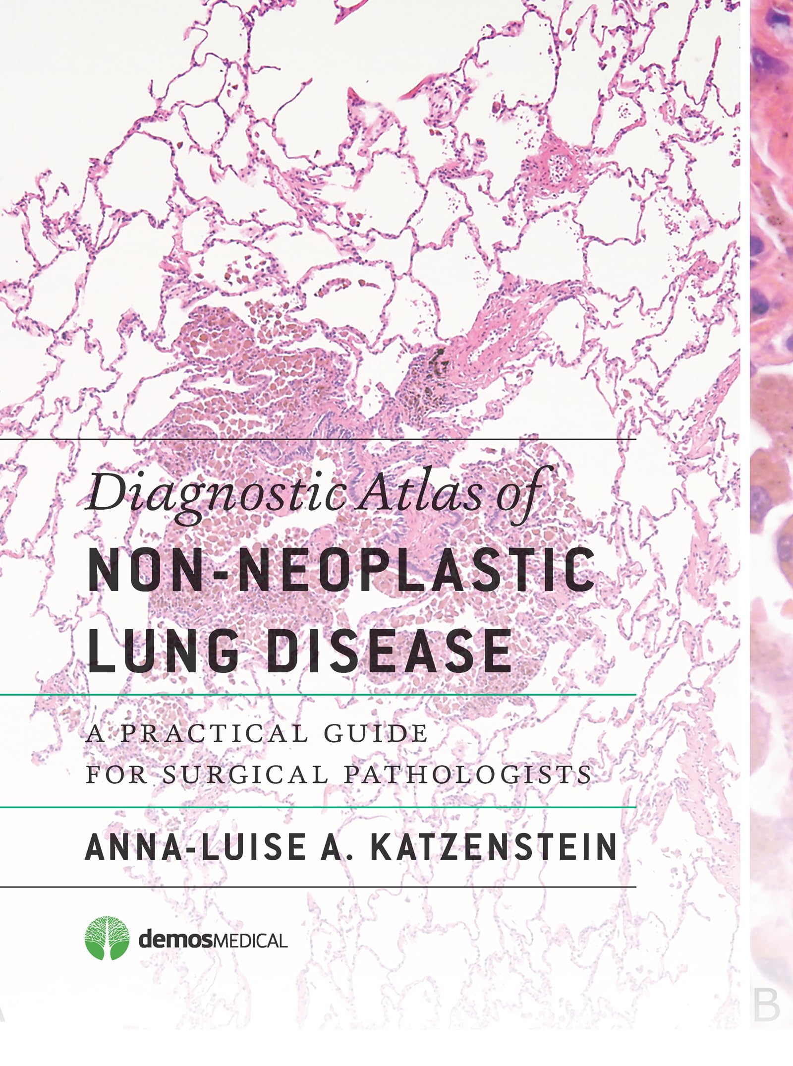 Diagnostic Atlas of Non-Neoplastic Lung Disease: A Practical Guide for Surgical Pathologists Medicine