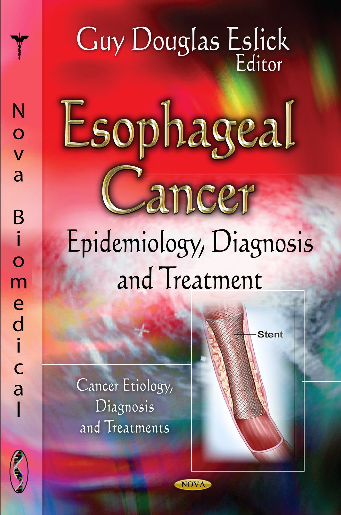 Esophageal Cancer: Epidemiology, Diagnosis and Treatment: Epidemiology, Diagnosis & Treatment (Cancer Etiology, Diagnosis and Treatments) Medicine