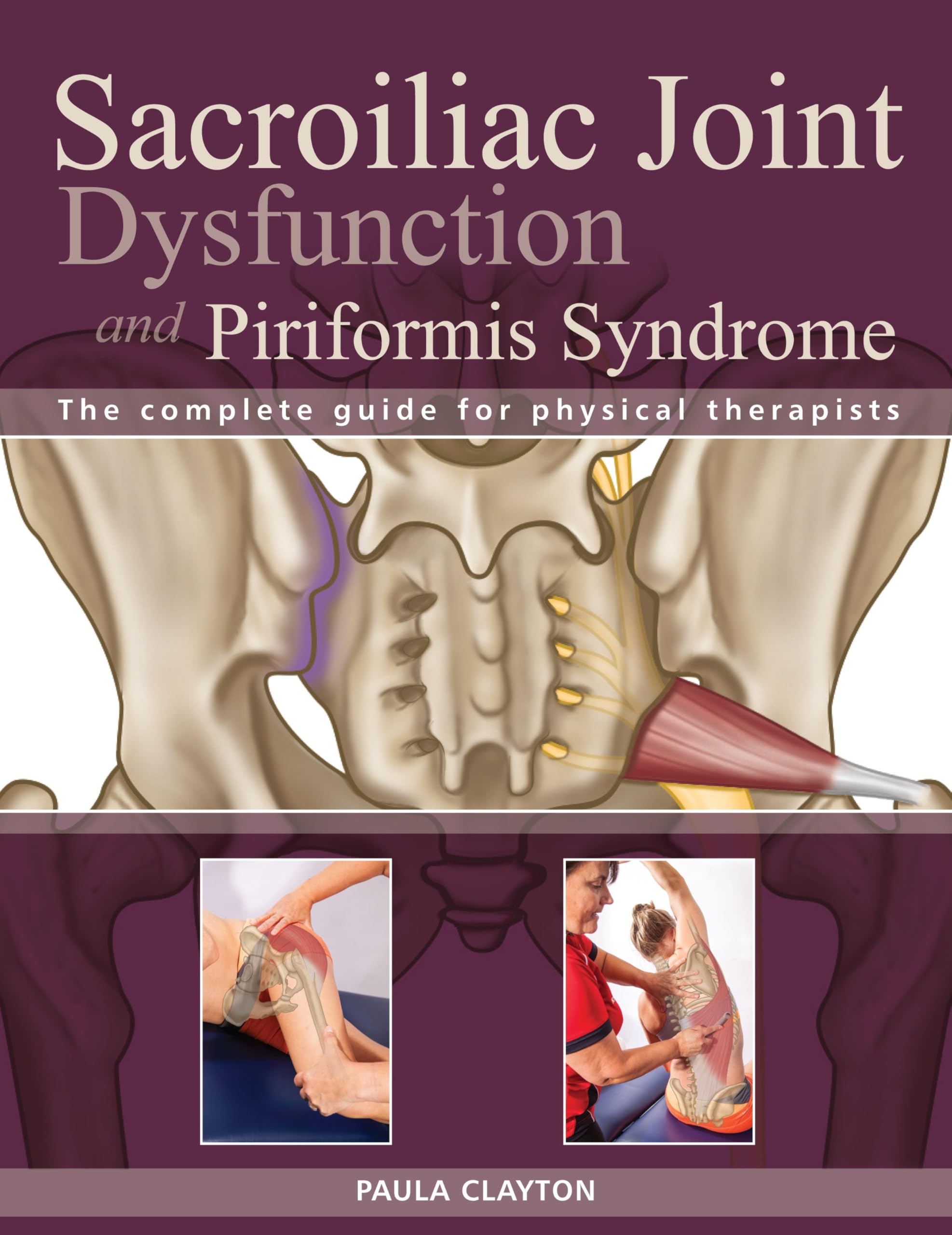 Sacroiliac Joint Dysfunction and Piriformis Syndrome: The Complete Guide for Physical Therapists Medicine