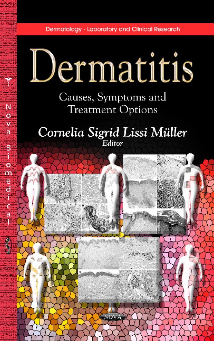 Dermatitis: Causes, Symptoms and Treatment Options: Causes, Symptoms & Treatment Options (Dermatology - Laboratory and Clinical Research) Medicine