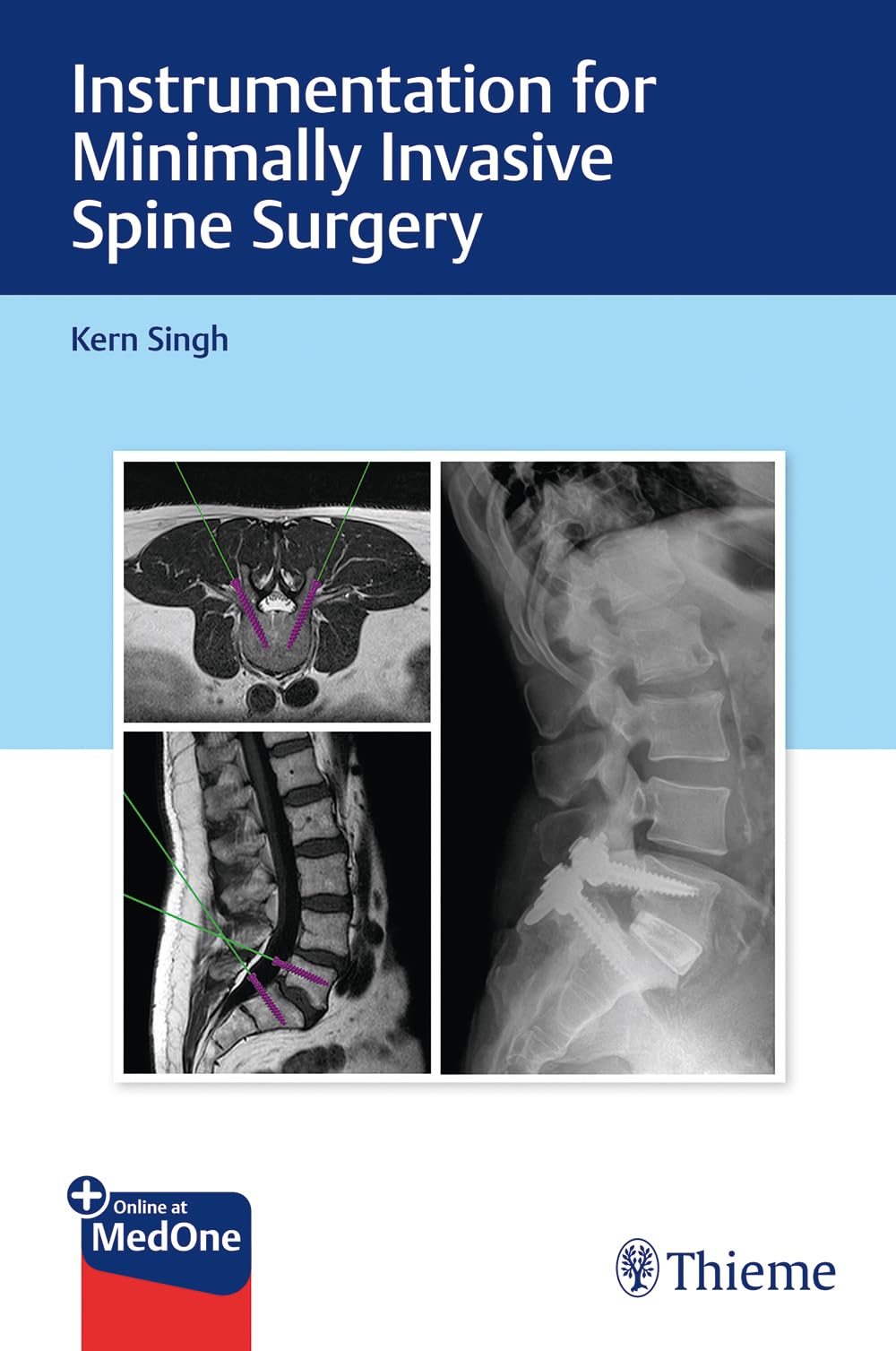 Instrumentation for Minimally Invasive Spine Surgery book