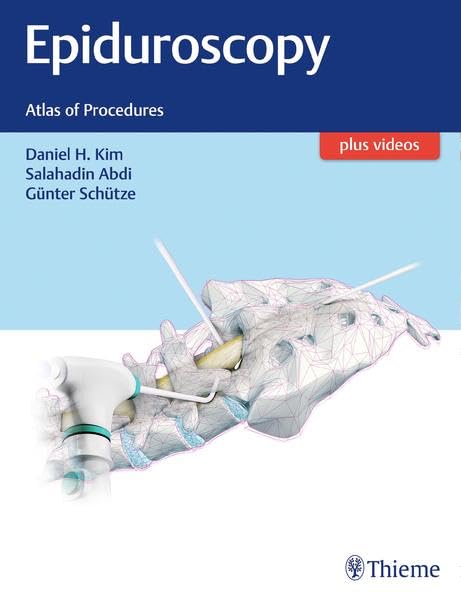 Epiduroscopy: Atlas of Procedures Medicine