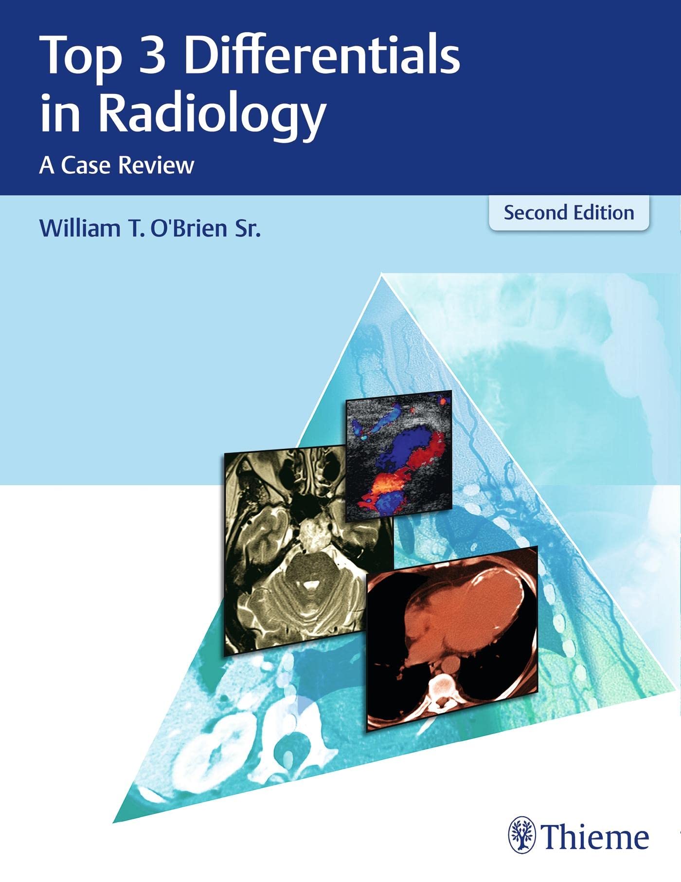 Top 3 Differentials in Radiology: A Case Review Medicine