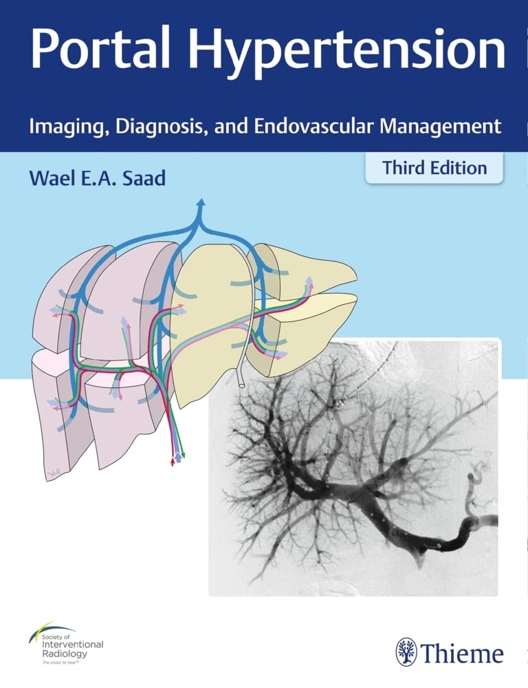 Portal Hypertension: Imaging, Diagnosis, and Endovascular Management Medicine