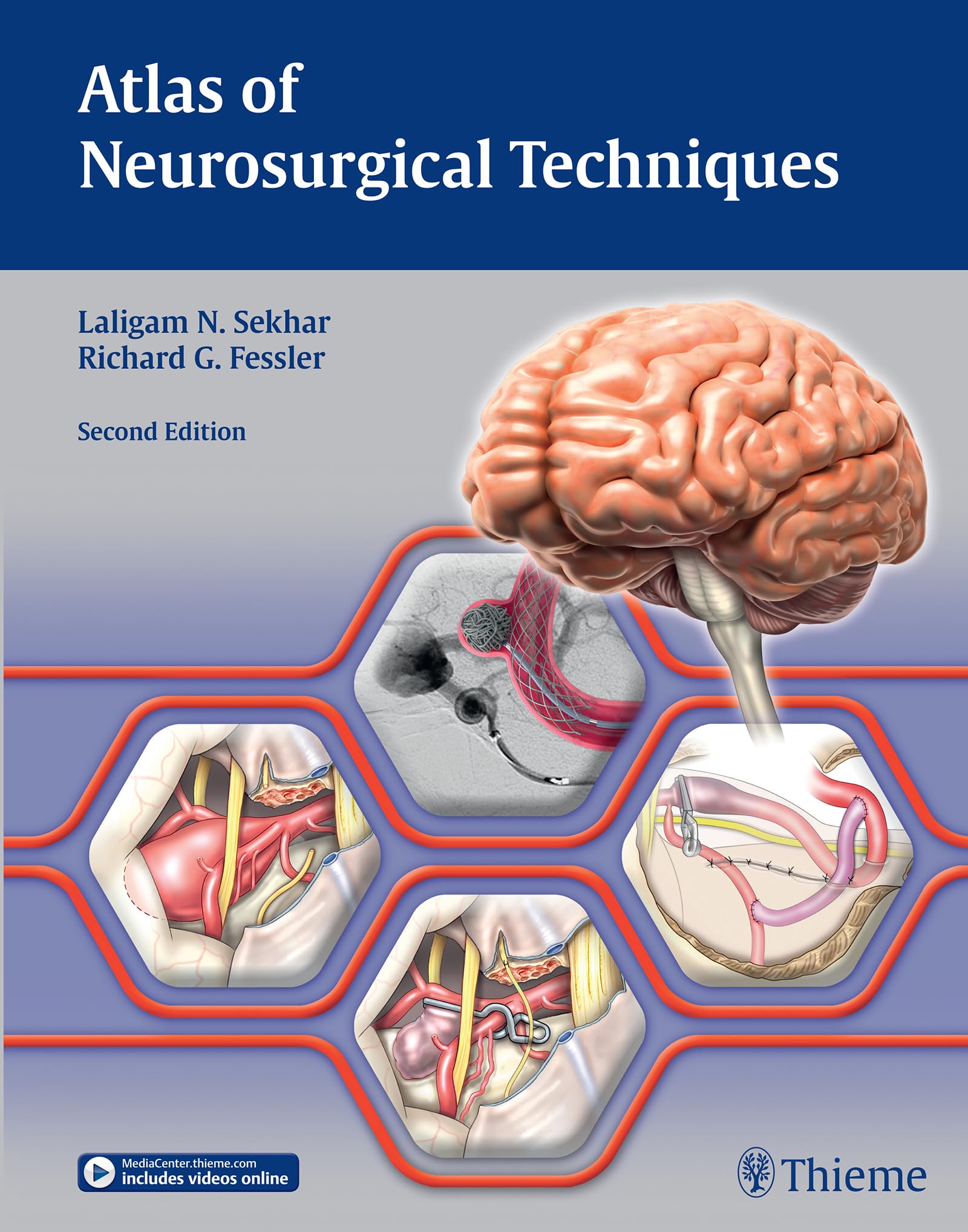 Atlas of Neurosurgical Techniques: Brain book