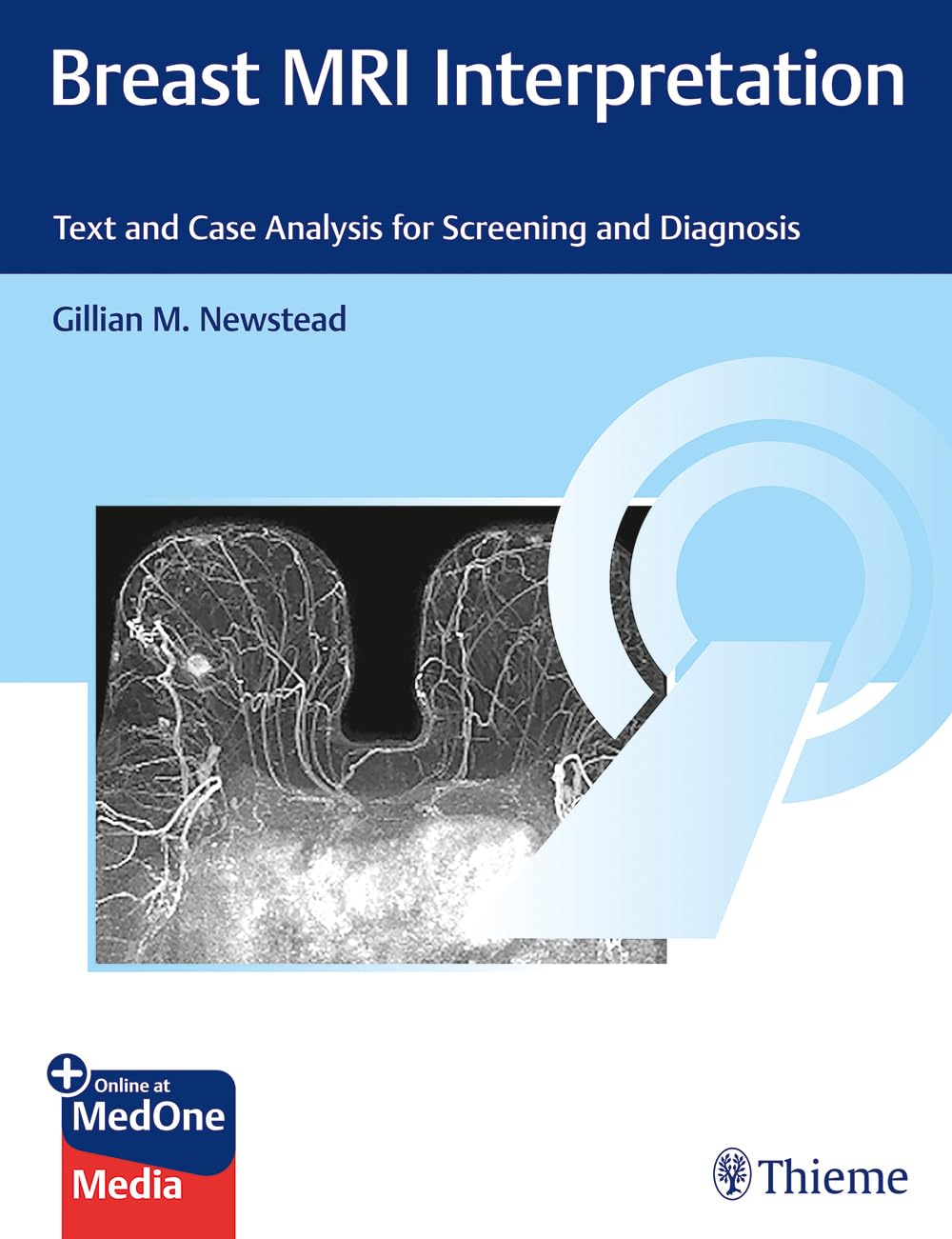 Breast MRI Interpretation: Text and Case Analysis for Screening and Diagnosis Medicine
