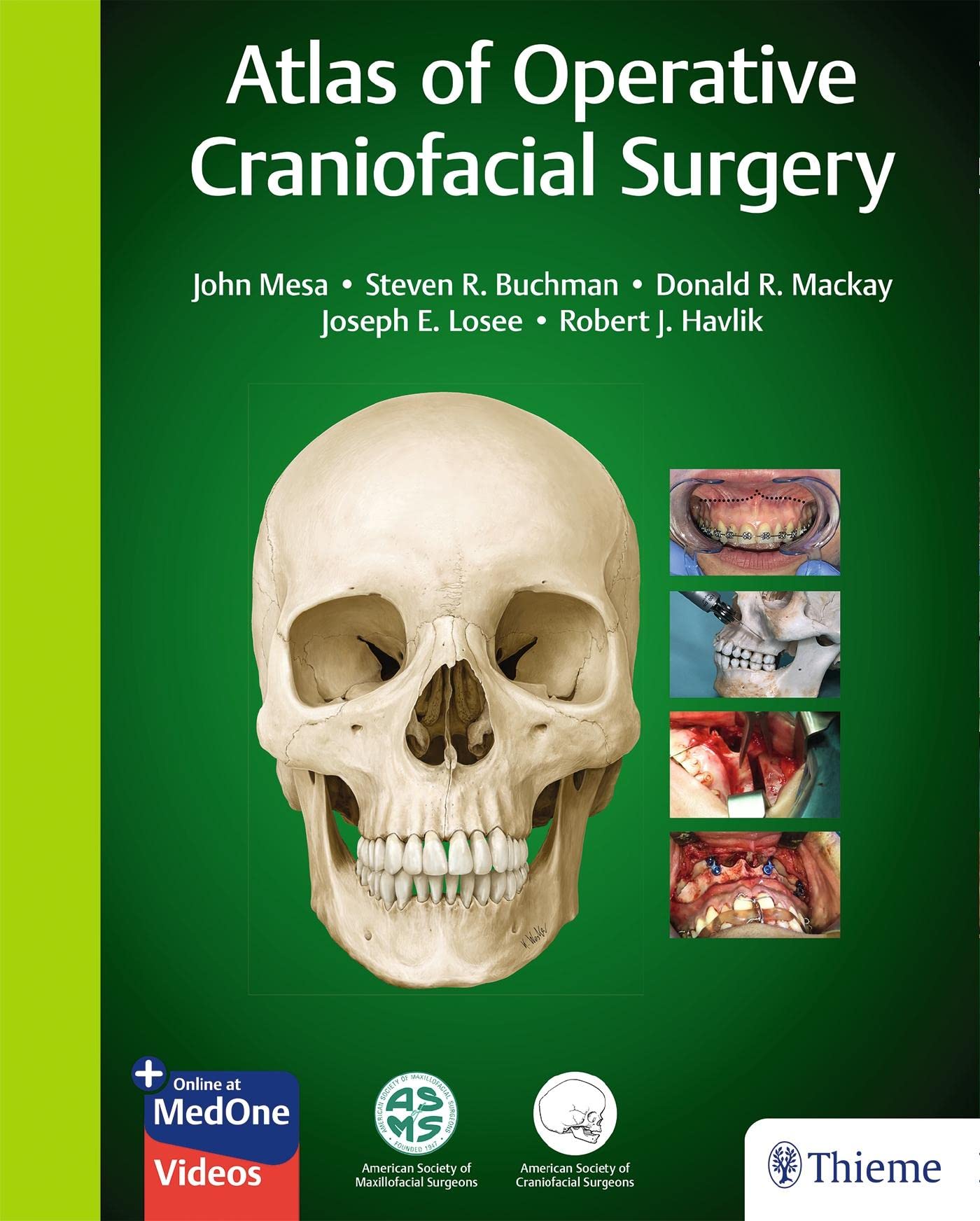 Atlas of Operative Craniofacial Surgery book
