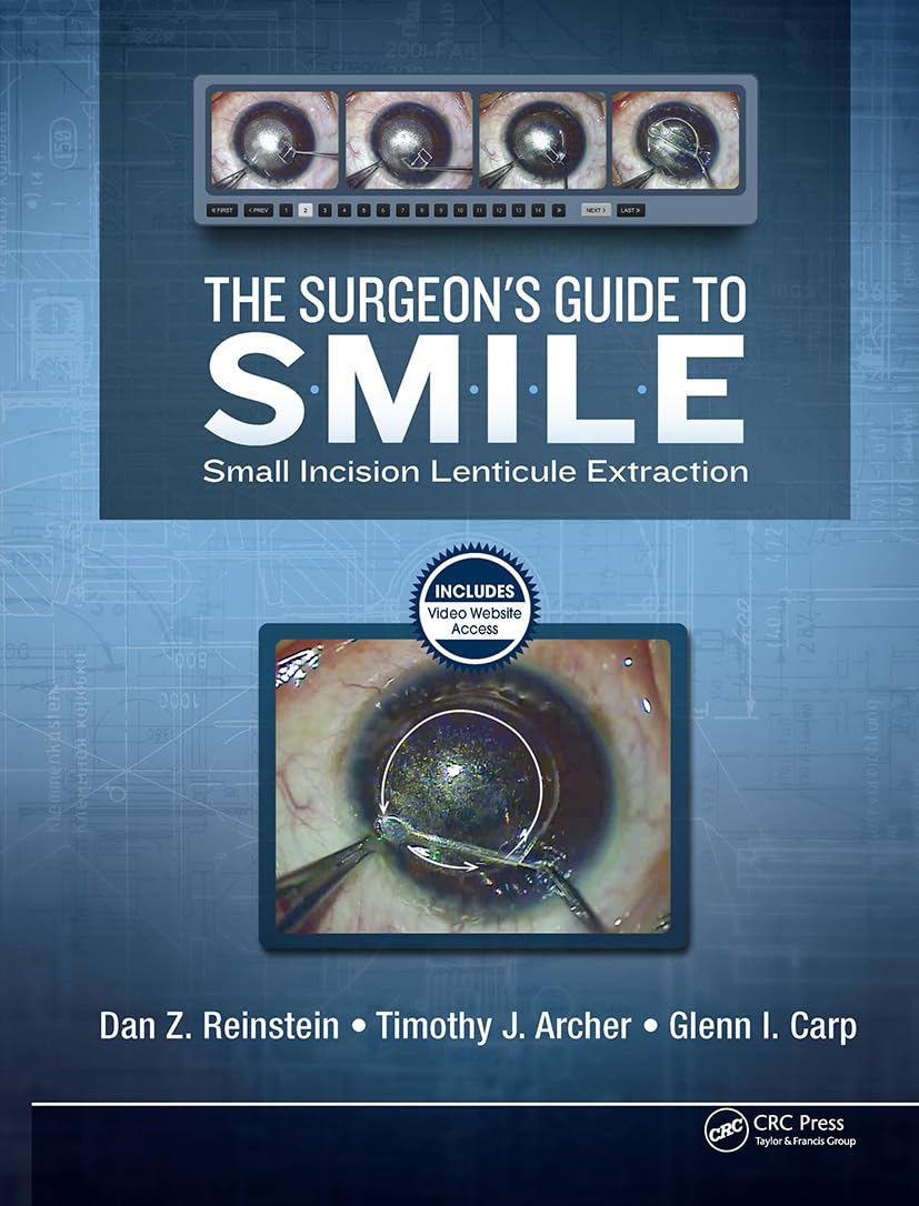 The Surgeon's Guide to Smile: Small Incision Lenticule Extraction book