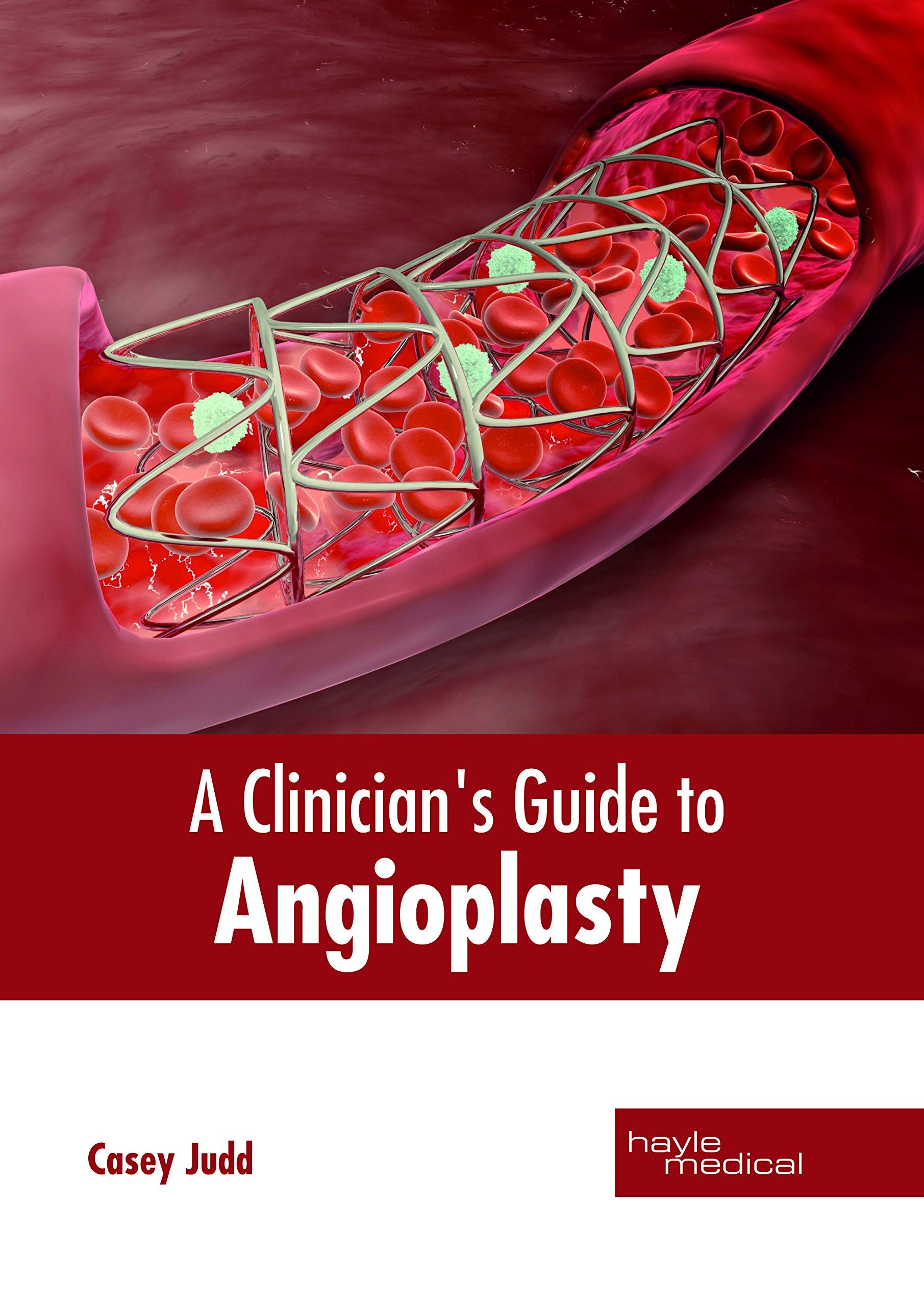 A Clinician's Guide to Angioplasty Medicine