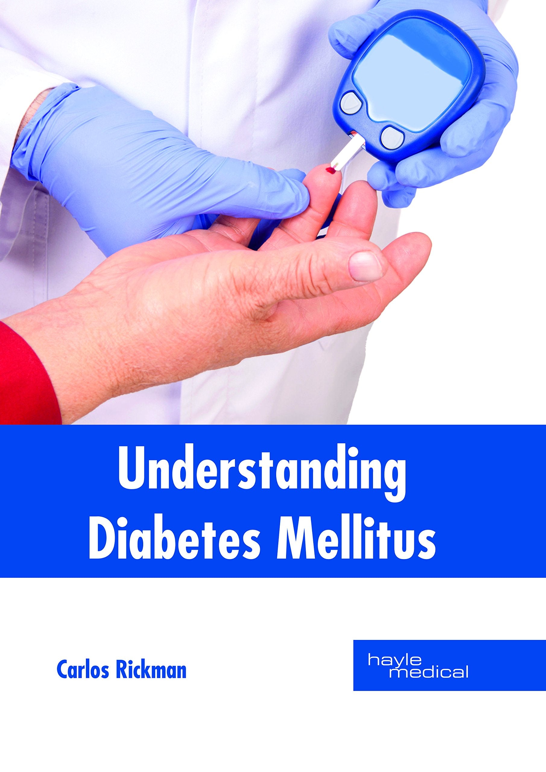 Understanding Diabetes Mellitus Medicine