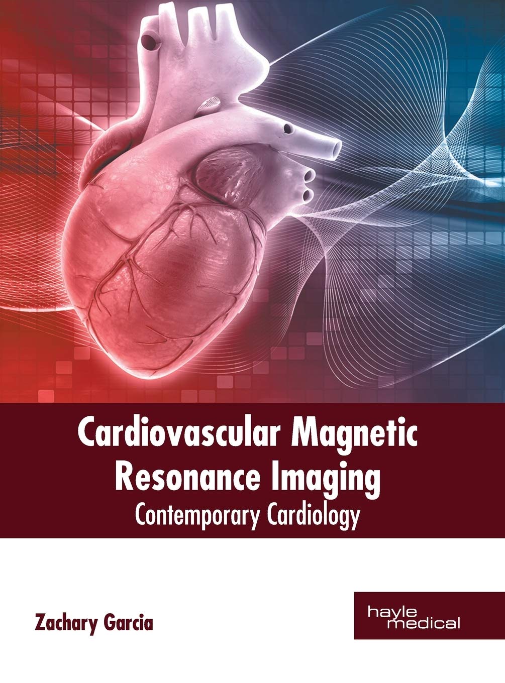 Cardiovascular Magnetic Resonance Imaging Medicine