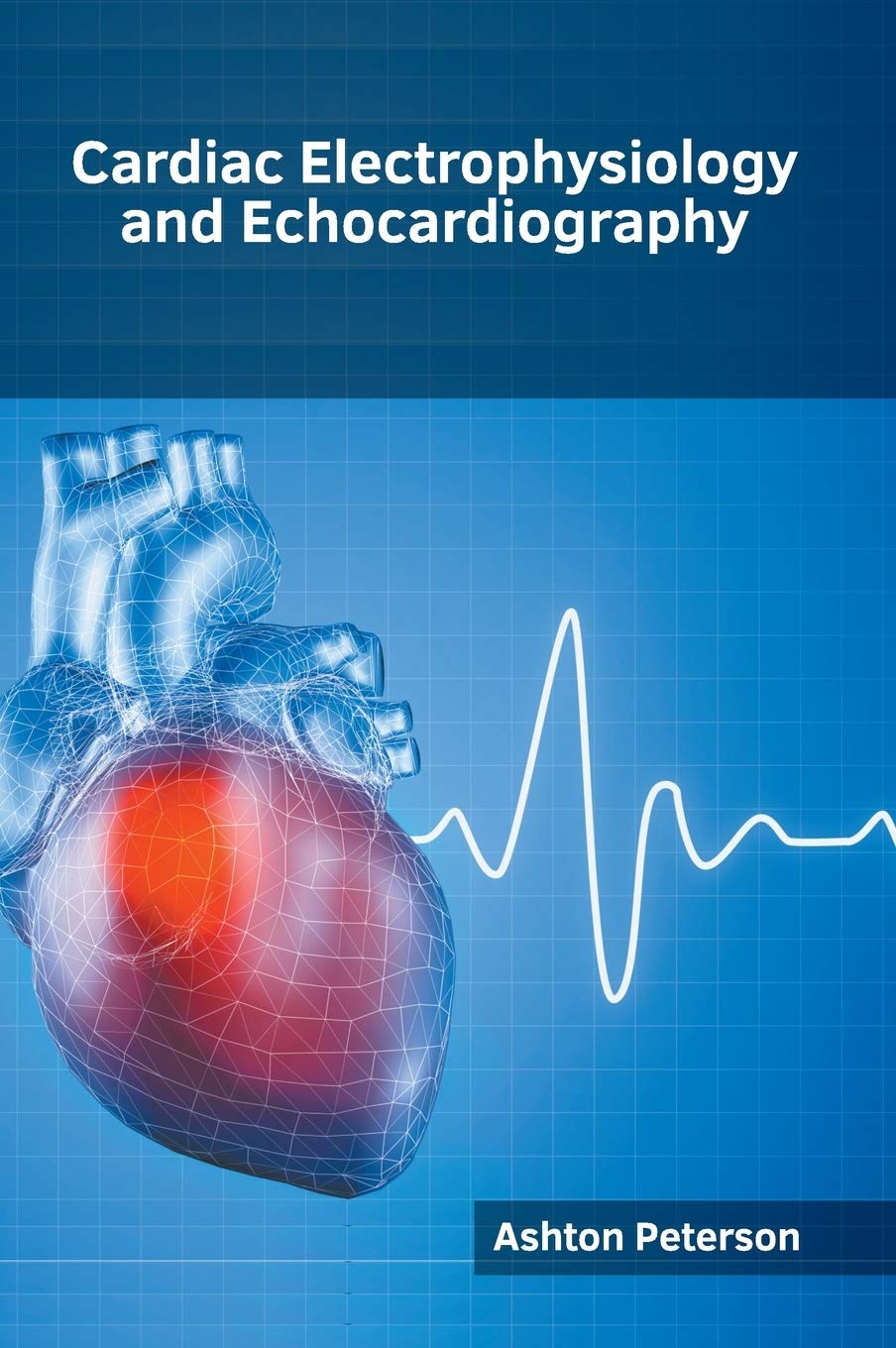 Cardiac Electrophysiology and Echocardiography Medicine
