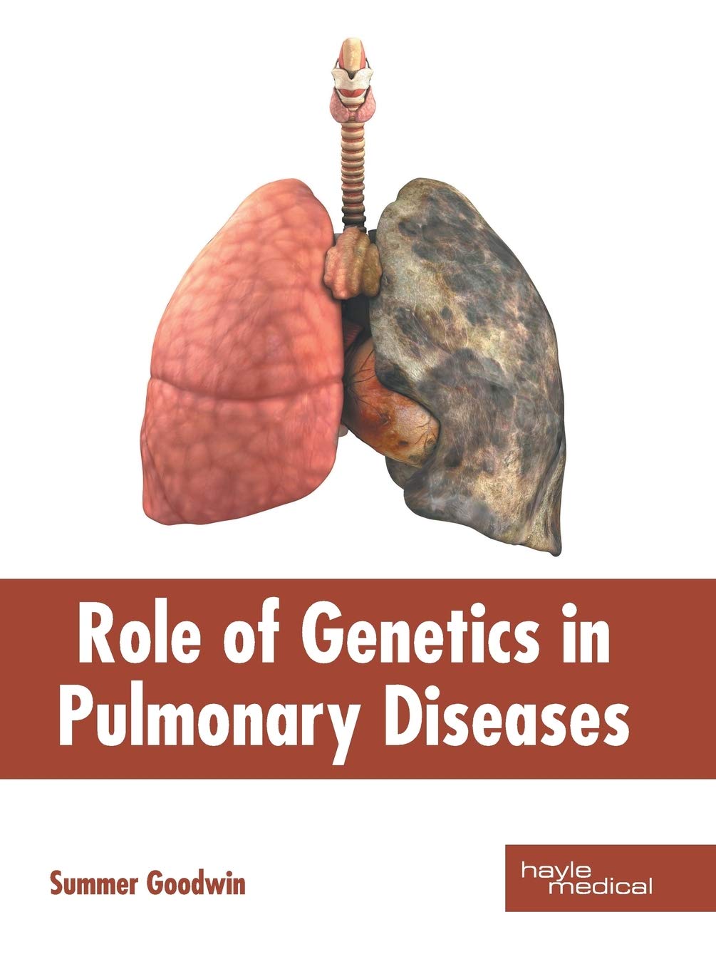 Role of Genetics in Pulmonary Diseases Medicine